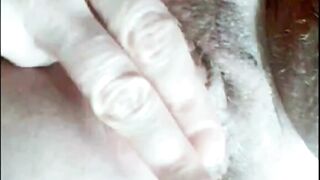 French Aunty's Private Gyno Cam Exam