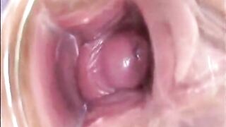 Girl's Tiring Doctor Visit: A Webcam Capture