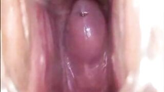 Girl's Tiring Doctor Visit: A Webcam Capture -2