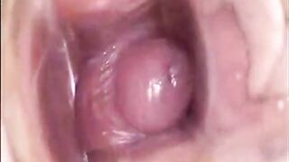 Girl's Tiring Doctor Visit: A Webcam Capture -2